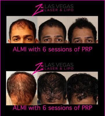 ALMI™ For Hair