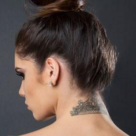 Laser Tattoo Removal in Las Vegas, NV