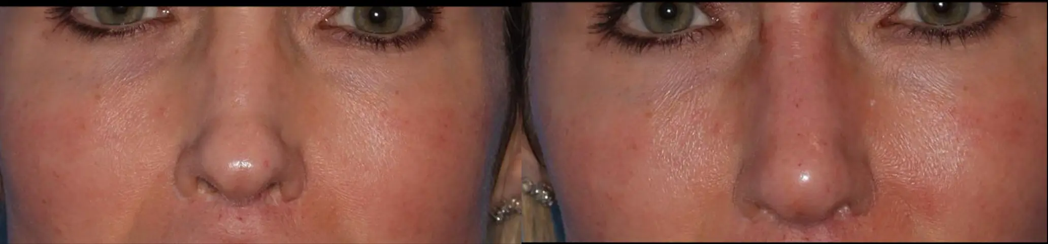 Close-up image of two female faces side by side, highlighting their eyes and cheeks. The photograph showcases subtle differences in skin tone and makeup application, emphasizing the natural beauty of each individual. Both women have dark eyelashes and well-groomed eyebrows, with a focus on their expressive eyes. The background is softly blurred, directing attention to their facial features. This image can be used in discussions about beauty standards, makeup techniques, or the diversity of facial features.