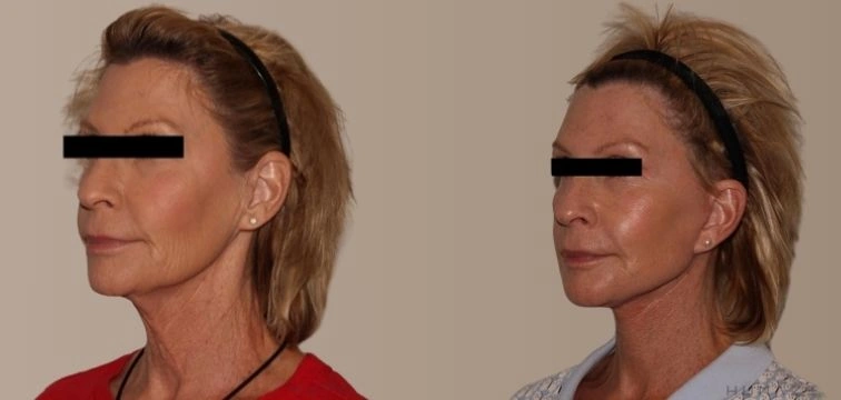 Two women with blonde hair are shown side by side. The woman on the left is wearing a red top and has her hair down, while the woman on the right is dressed in a patterned blouse and has her hair styled differently. The image focuses on their profiles, highlighting their facial features and expressions. The background is neutral, emphasizing the subjects. This image can be used in discussions about comparison, beauty standards, or personal style.