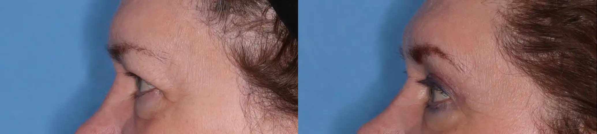 Close-up image showing a textured surface of hair on the left side and a smooth blue background on the right side. The hair exhibits natural curls and fine strands, highlighting the contrast between the organic texture and the uniform color of the blue backdrop. This image can be used to discuss topics related to hair care, styling techniques, or color theory in design.