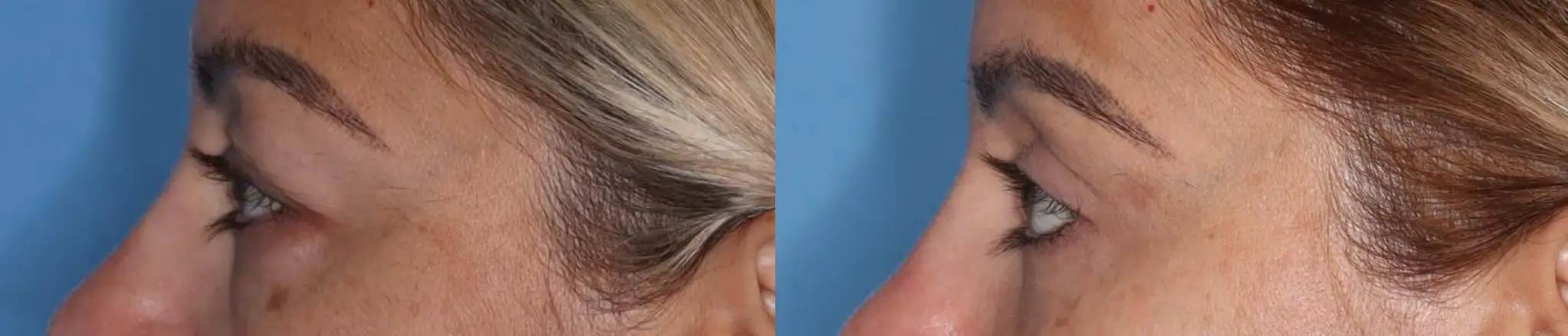 Close-up image showing a woman's hair on the left side, with blonde and brown highlights, and a hand on the right side, displaying well-manicured nails against a blue background. The image highlights the contrast between hair texture and nail care, emphasizing beauty and grooming. Ideal for topics related to hair care, nail artistry, and personal grooming tips.