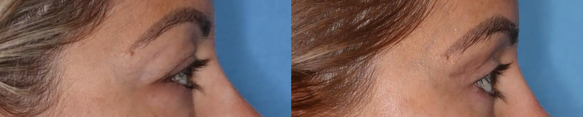 Close-up image showcasing two sections of hair against a blue background. The left side features smooth, straight hair with a shiny finish, while the right side displays wavy hair with a textured appearance. This image highlights different hair types and styles, emphasizing hair care and styling techniques. Ideal for discussions on hair health, product recommendations, or beauty tutorials.