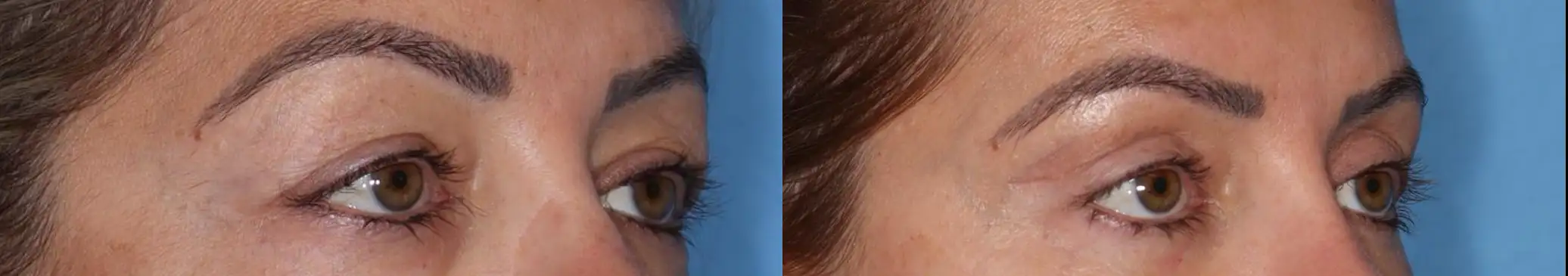 Close-up comparison of two human eyes, showcasing different eye colors and eyelash lengths. The left side features a brown eye with long eyelashes against a blue background, while the right side displays a lighter eye color with shorter eyelashes. This image highlights the diversity in eye characteristics, which can be influenced by genetics and individual traits. Ideal for discussions on eye anatomy, beauty trends, or genetic variations.