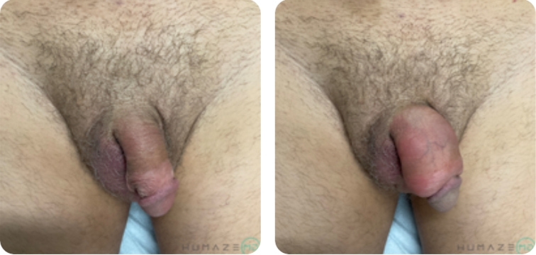 Image showing a close-up of a male torso and armpit area, highlighting skin texture and hair. The focus is on the natural appearance of the skin, with emphasis on the anatomical features. The image is intended for educational purposes, illustrating human anatomy and grooming practices. It is important for discussions related to personal care and hygiene.