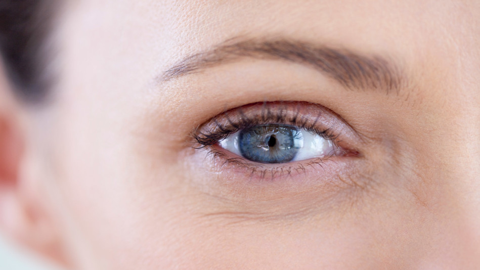 Picking the Right Anti-Wrinkle Injection: Botox vs Dysport